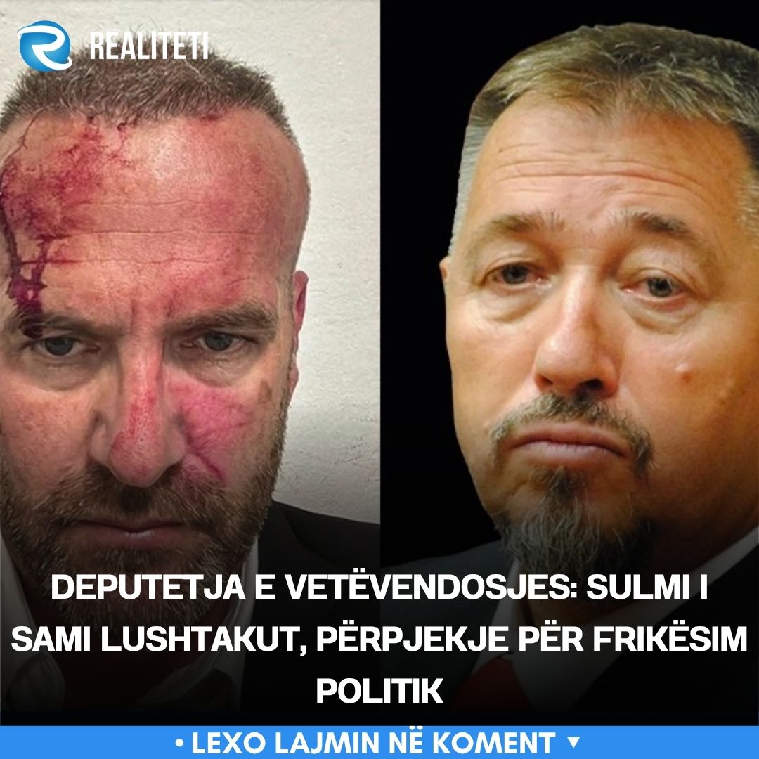 deputetja-e-vetevendosjes-sulmi-i-sami-lushtakut-perpjekje-per-frikesim-politik