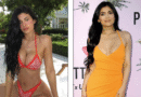 Kylie Jenner zbulon sekretet e kirurgjisë plastike në një përgjigje tronditëse ndaj kërkesës së fansave