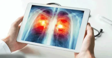FDA miraton pilulën e parë për kancerin më të përhapur të mushkërive në stad të avancuar